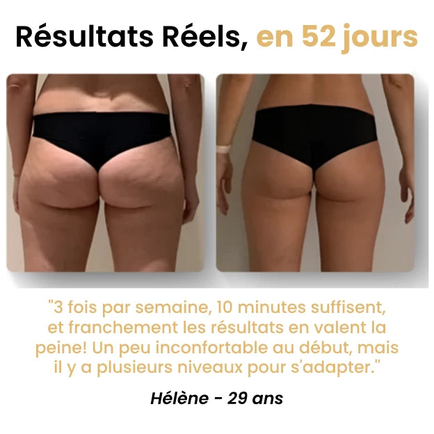 Masseur Anti-Cellulite - Novaya™