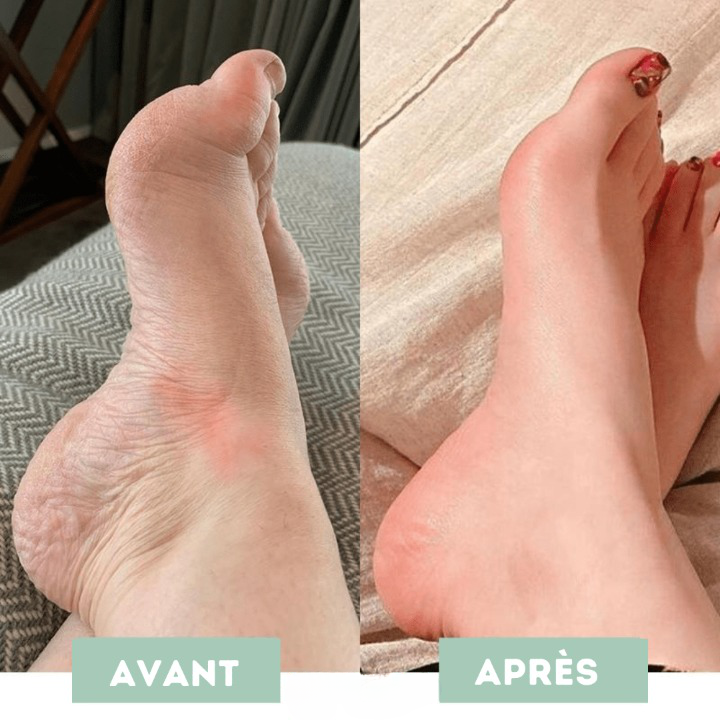 Mass'Pieds Revitalisant EMS | ArtiCare™