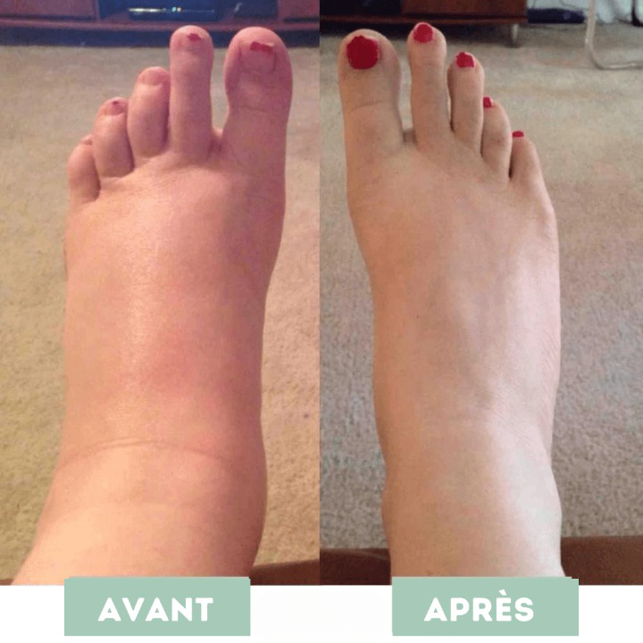 Mass'Pieds Revitalisant EMS | ArtiCare™