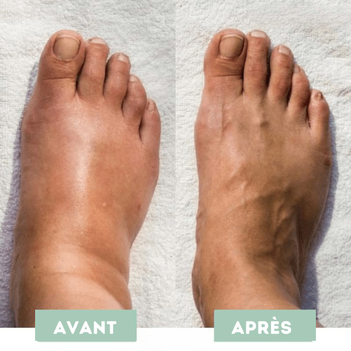 Mass'Pieds Revitalisant EMS | ArtiCare™