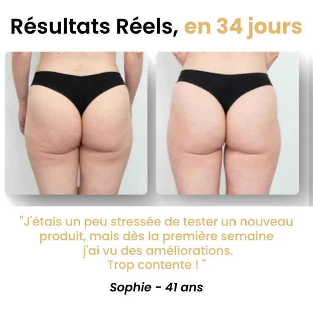 Masseur Anti-Cellulite - Novaya™